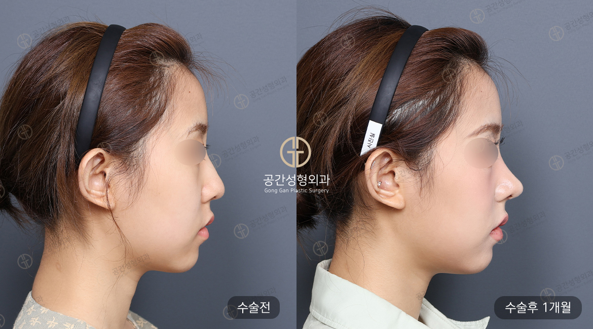 케이스코 이미지