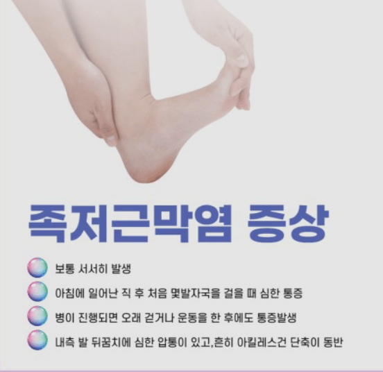  여름철 샌들을 자주 신으면 안되는 이유!!!!