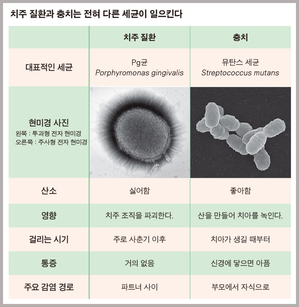치과 치료 시 주의사항