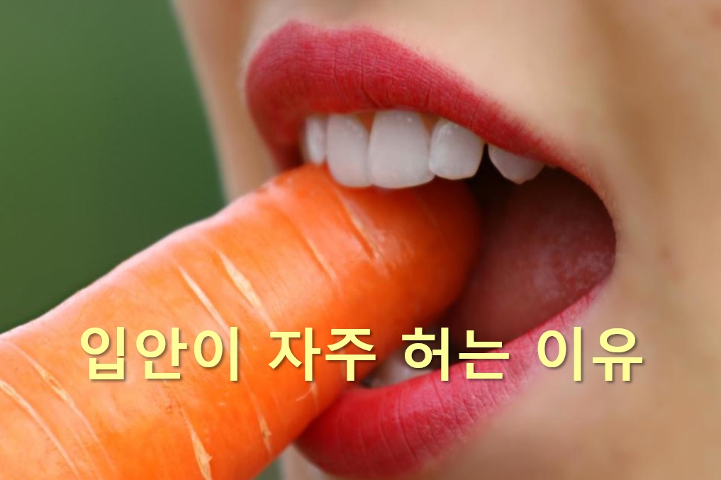  입안이 자주 허는 이유와 입안이 헐었을 때 좋은 음식