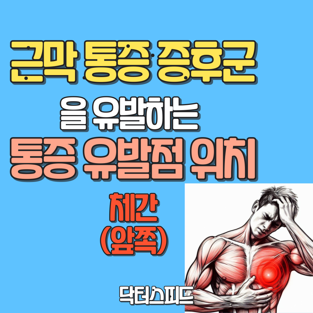 체간 앞쪽의 통증유발점 위치