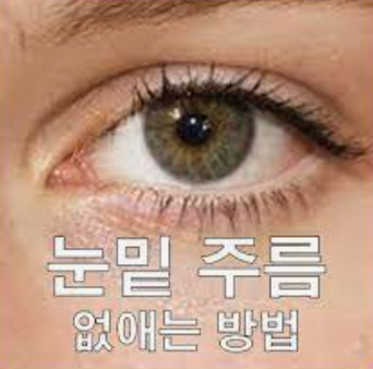  눈밑 주름 가장 효과적으로 없애는 방법 Best 3 (보톡스, 제거수술, 레이저)