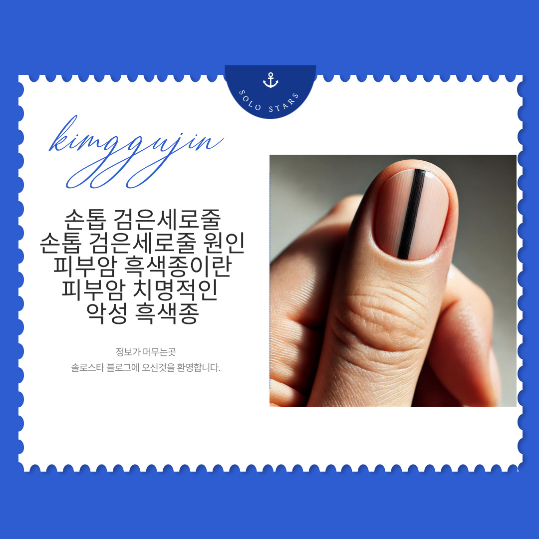 손톱 검은세로줄 사진