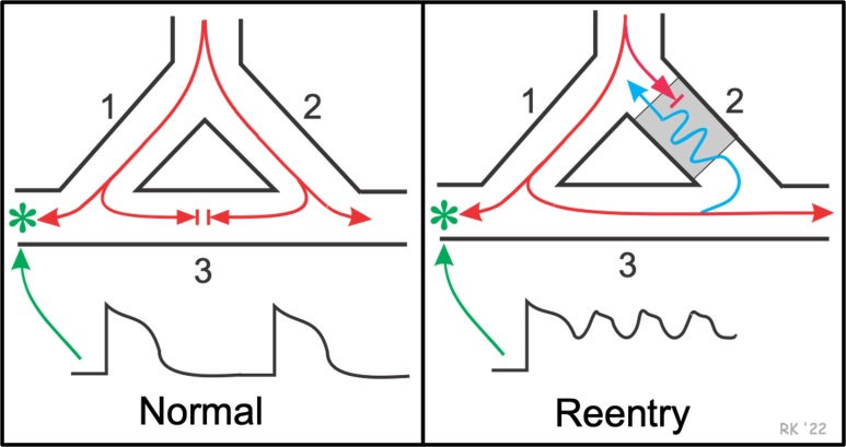 회귀 reentry