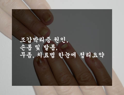 조갑박리증 원인&#44; 손톱 및 발톱&#44; 무좀&#44; 치료법 한눈에 정리요약