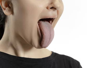 뇌전증 증상 18