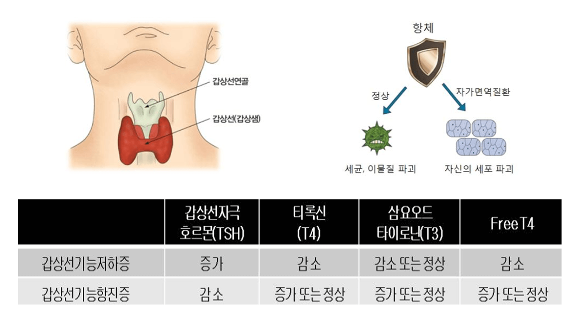 갑상선기능 설명 이미지