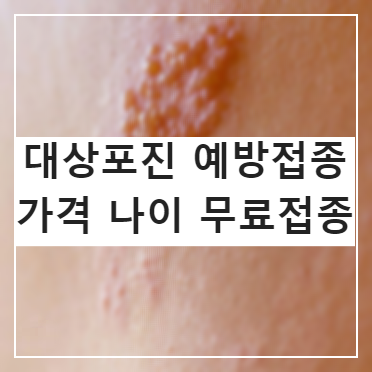 대상포진 예방접종 가격 1회면 되나요? 무료 나이