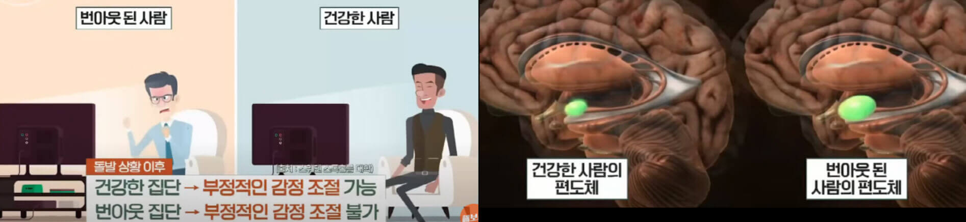 번아웃-된-사람과-건강한-사람의-뇌의-감정적-조절기능- 편도체-반응