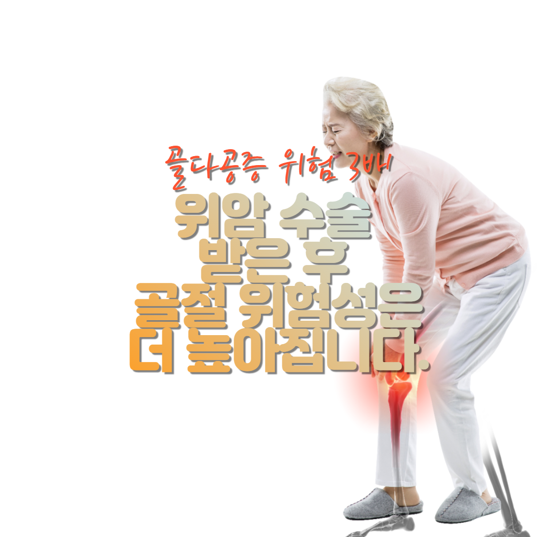  위암 수술 받은 후 골절 위험성은 더 높아집니다.