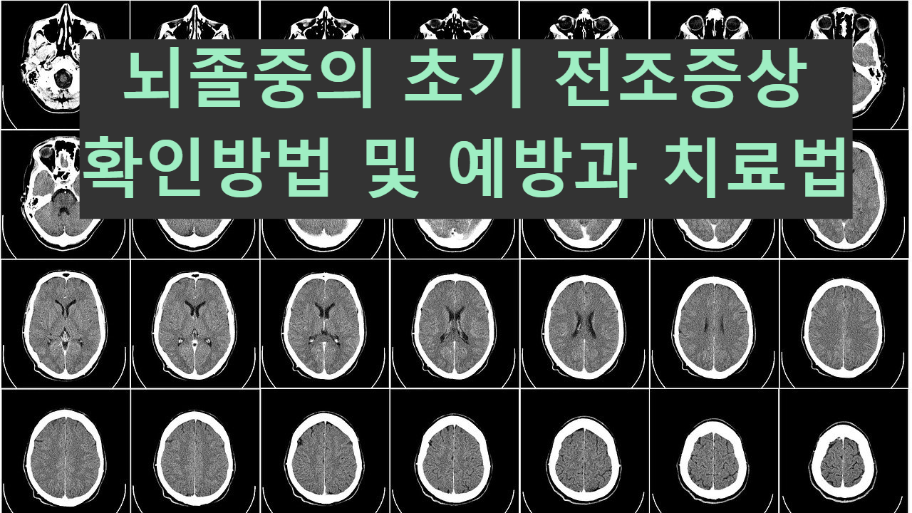  뇌졸중의 초기 전조증상 확인방법 및 예방과 치료법