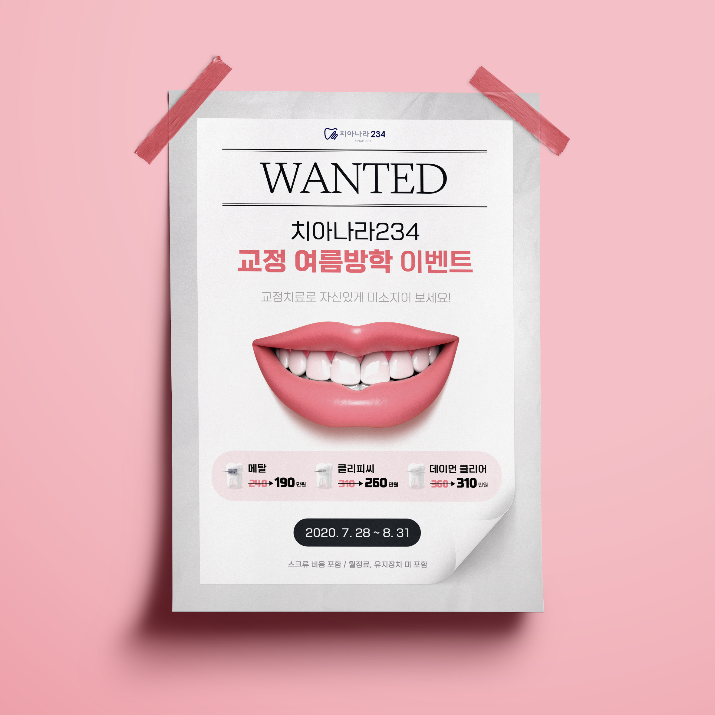  치아나라234 치과 교정 이벤트 포스터 디자인(퍼펭스튜디오)