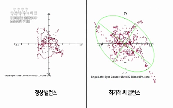 [821회] 생로병사의 비밀 - KBS821회] 생로병사의 비밀.ts_20220824_145724.567.jpg