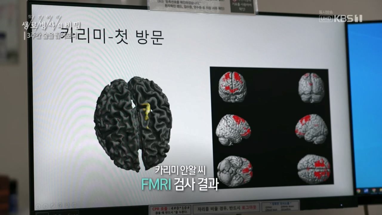 생로병사의 비밀.E865.230420p.H264-F1RST.mp4_20230420_202158.304.jpg