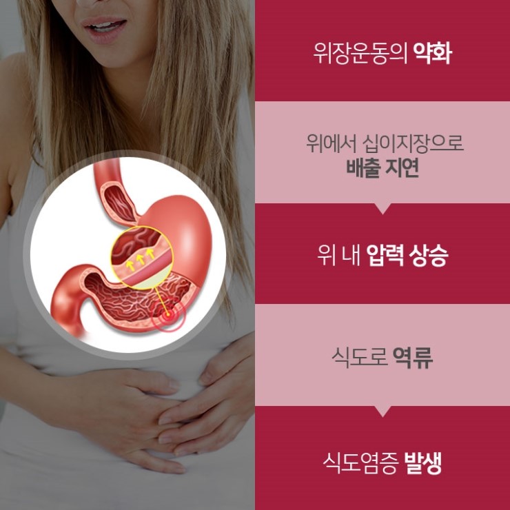 역류성 식도염 증상 가슴 통증 역류성식도염 가슴통증 5
