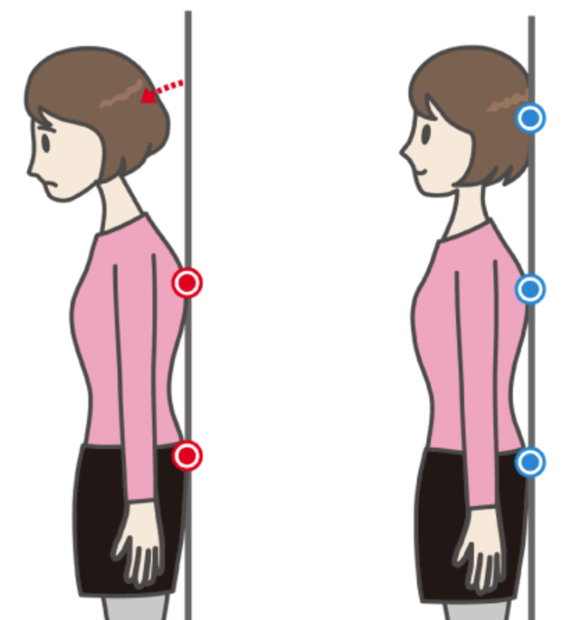 일자목-증후군과-정상-자세