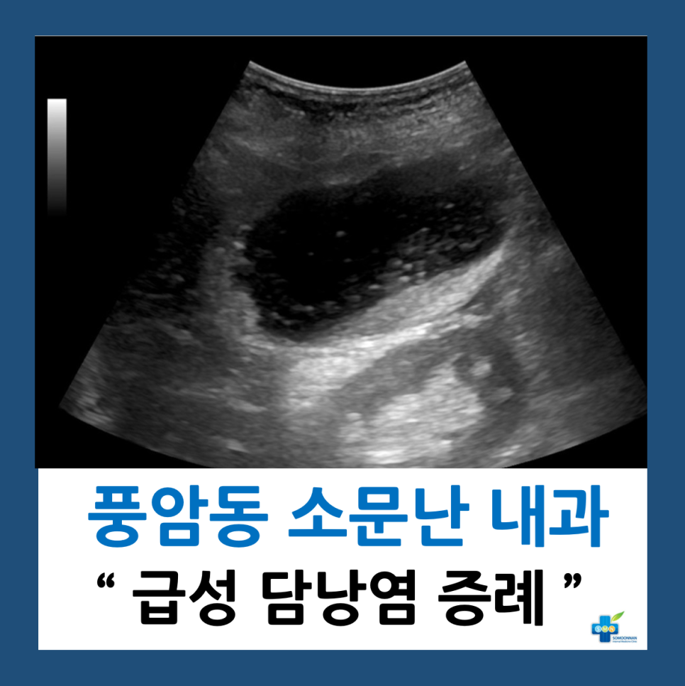 소문 이미지