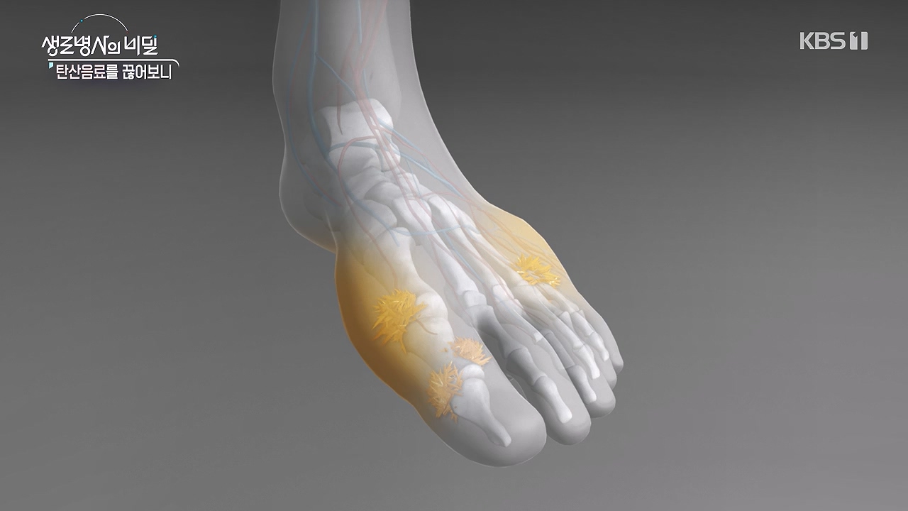 생로병사의 비밀.E913.240530p-NEXT.mp4_20240530_202919.232.jpg