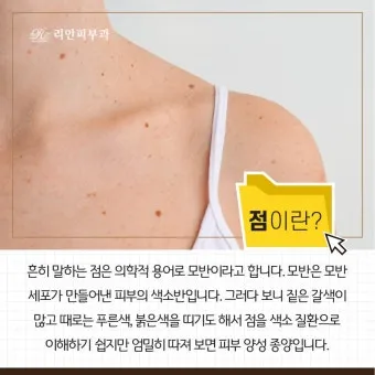 몸에 점이 계속 생기는 이유 원인부터 예방법까지 한눈에_8