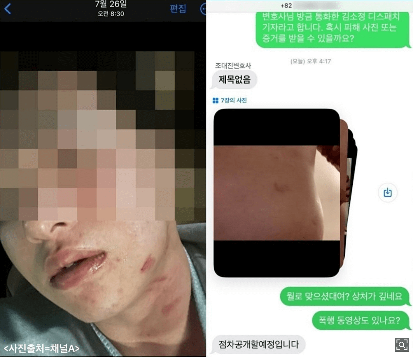 김하성 선수 폭행사건 