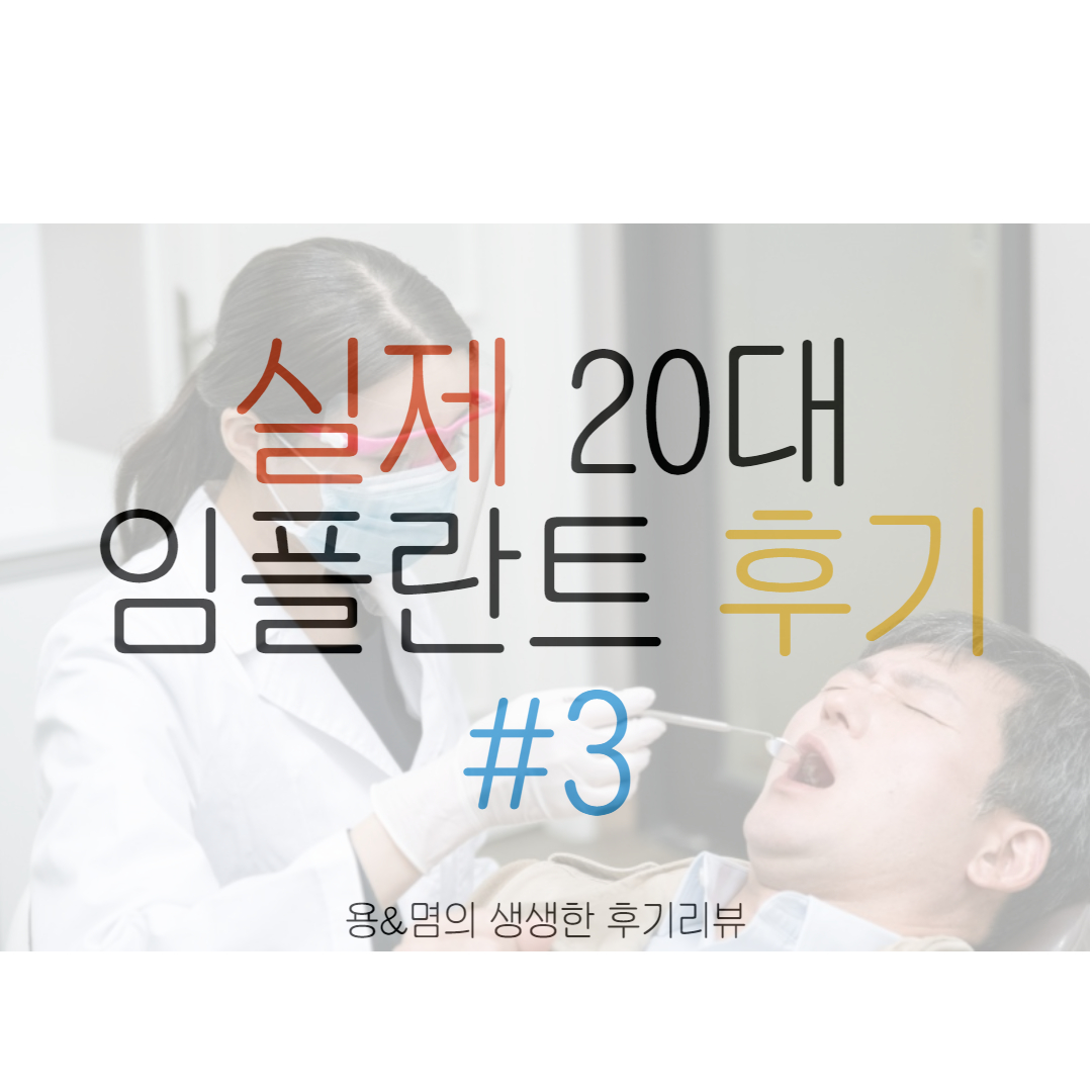 20대 임플란트 후기#3 임플란트 시간, 임시치아를 하는 이유