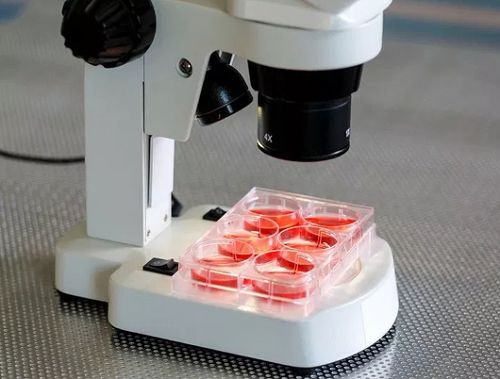 Eosinophil 수치