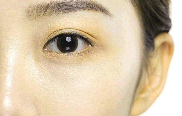  눈 밑 떨림, 눈 떨리는 원인 7가지 : 예방법