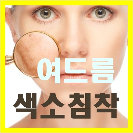  색소침착 없애는 방법 무엇일까?