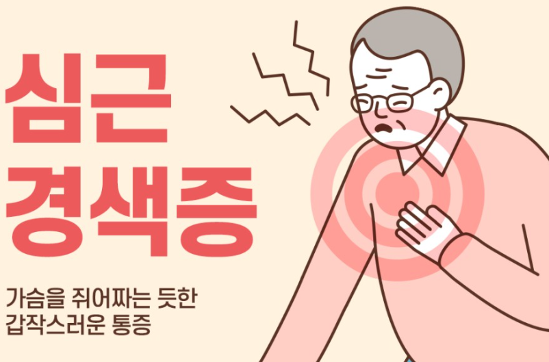 심근경색증-일러스트