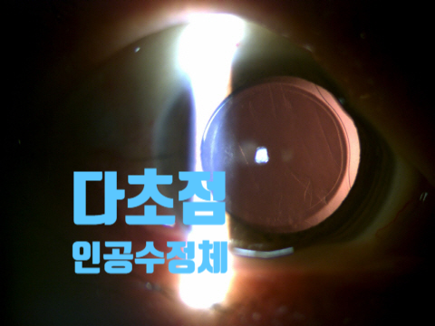대전성모안과 이미지