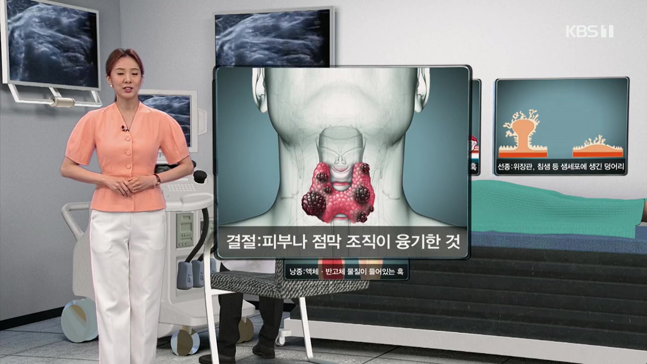 생로병사의 비밀.E870.230532p.H264-F1RST.mp4_20230605_195527.229.jpg