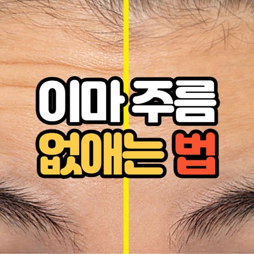 이마 주름 없애는법