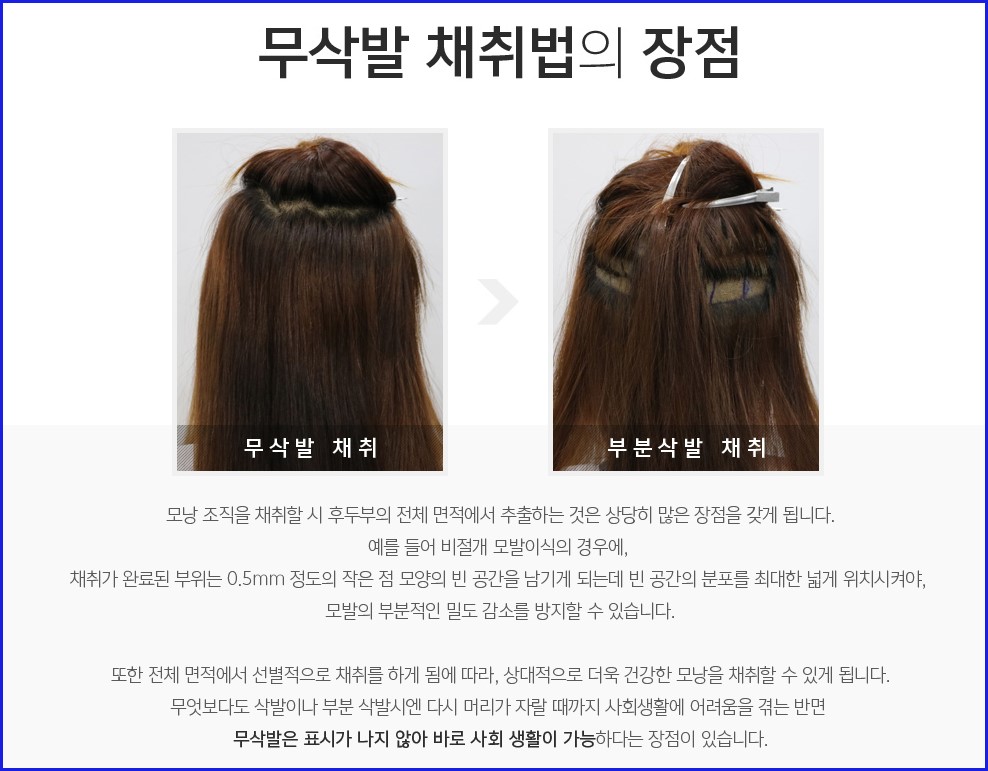 무삭발 채취법