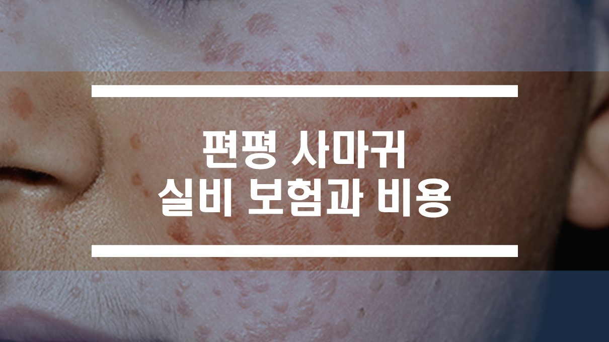  편평 사마귀 실비보험과 레이저 치료 비용