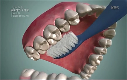 [670회] 생로병사의 비밀 - KBS670회] 생로병사의 비밀.ts_20220505_142247.294.jpg