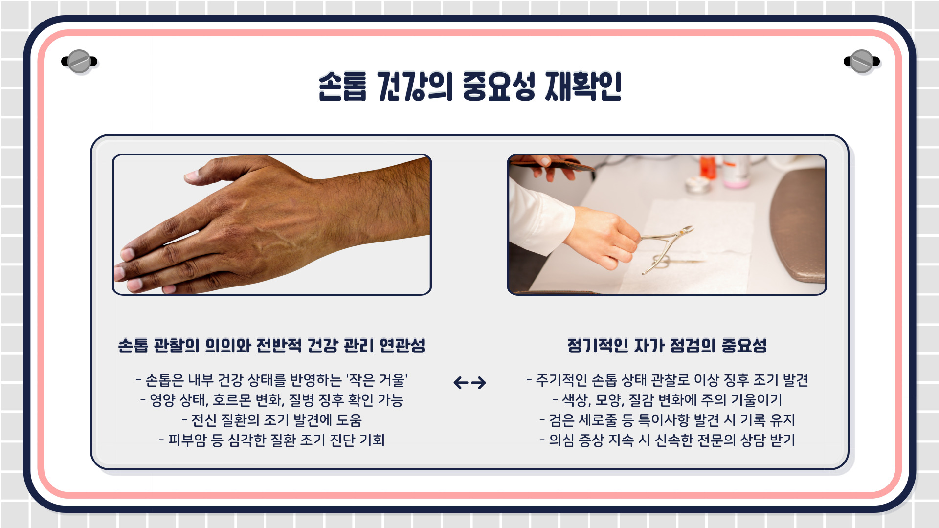 손톱 검은 세로줄