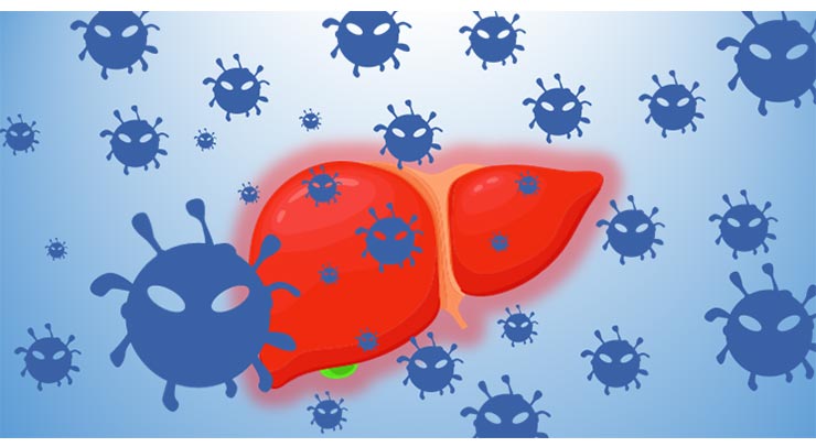  바이러스성 간염(viral hepatitis) A형간염, B형간염 등 총 6가지 종류 파헤치기