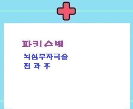  파병수술전후