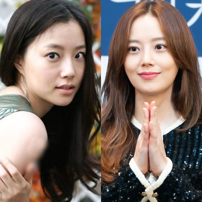  배우 문채원 과거 성형 여부 및 따돌림 사건