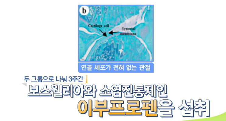 보스웰리아 효능