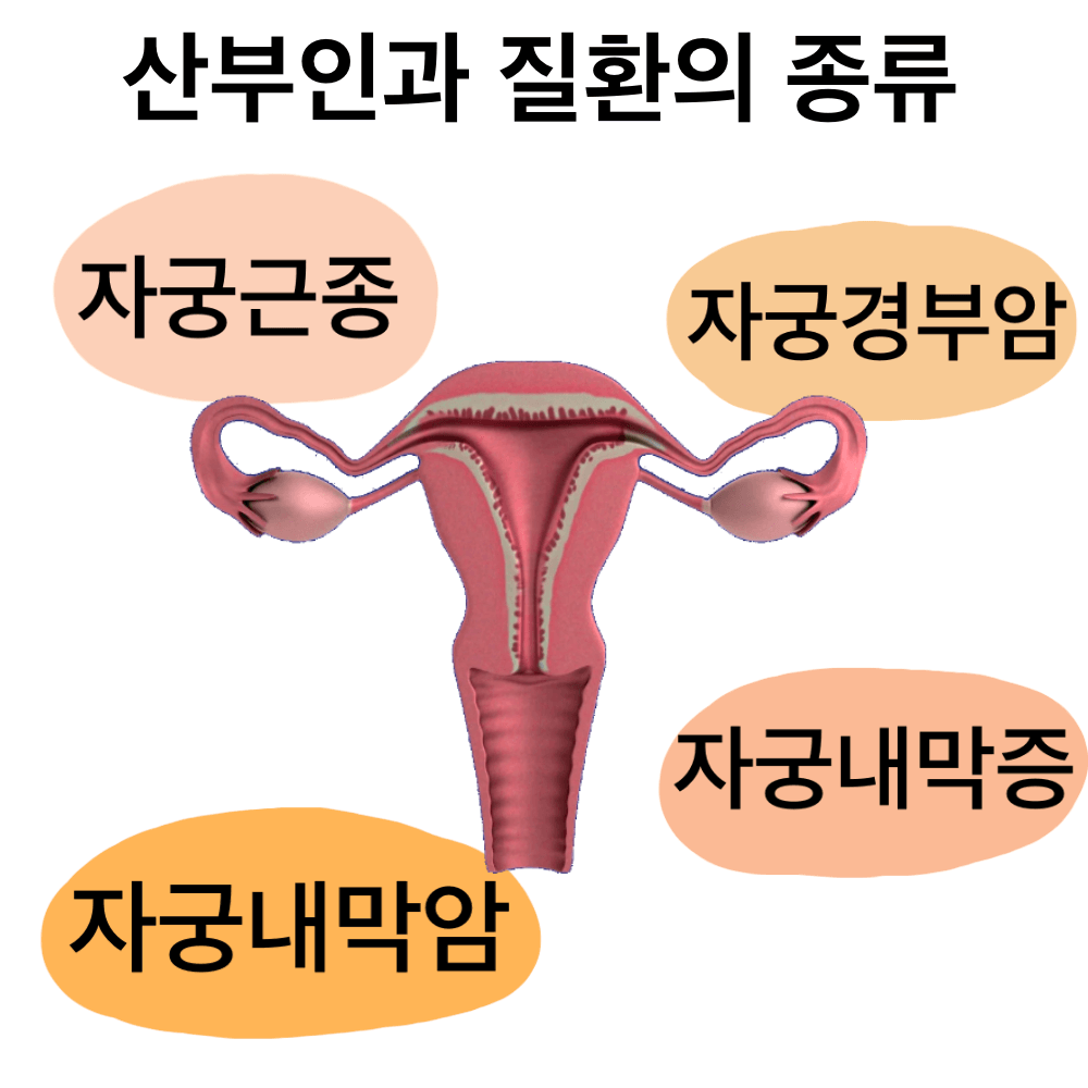 산부인과 자궁근종 자궁경부암 자궁내막증 자궁내막암 로봇수술 실비