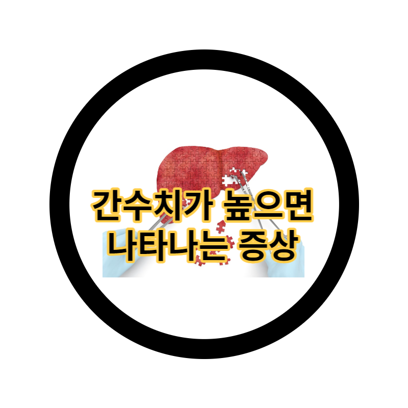  간수치가 높으면 나타나는 증상 7가지 간수치 내리는 방법