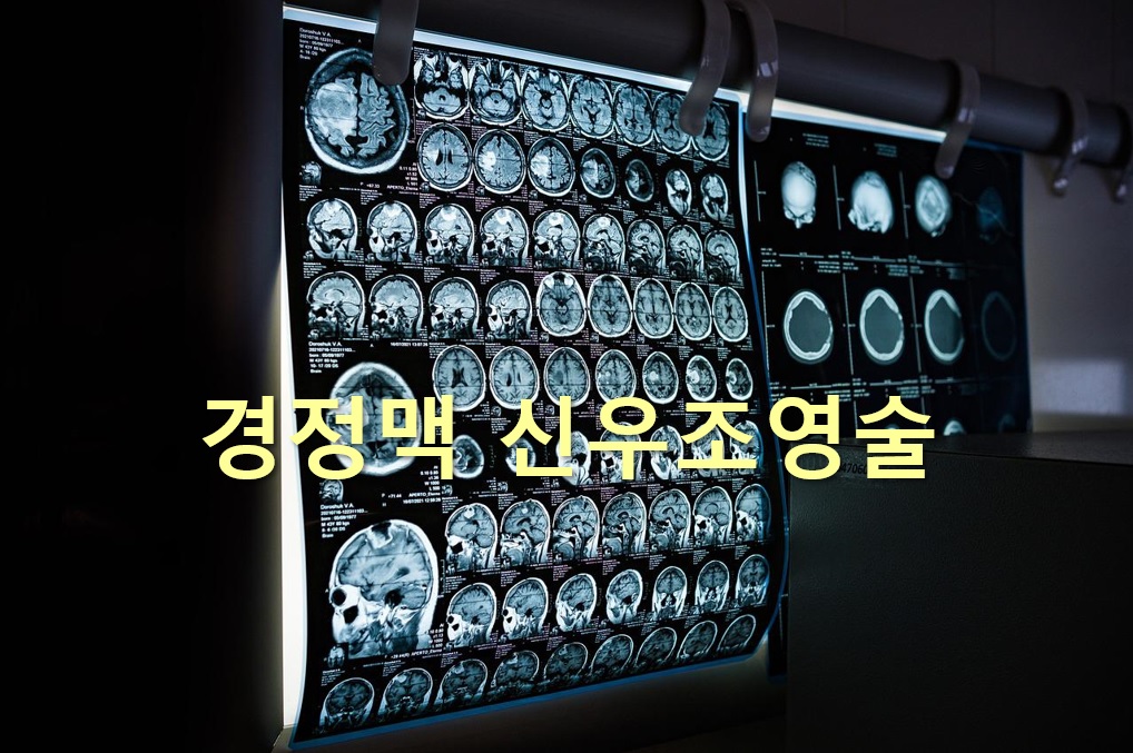  혈뇨나 신장과 방광의 문제를 진단하는 경정맥 신우조영술
