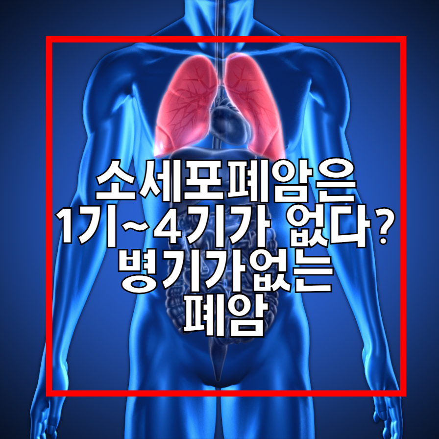  소세포폐암(feat증상,진단,수술 및 예방방법)