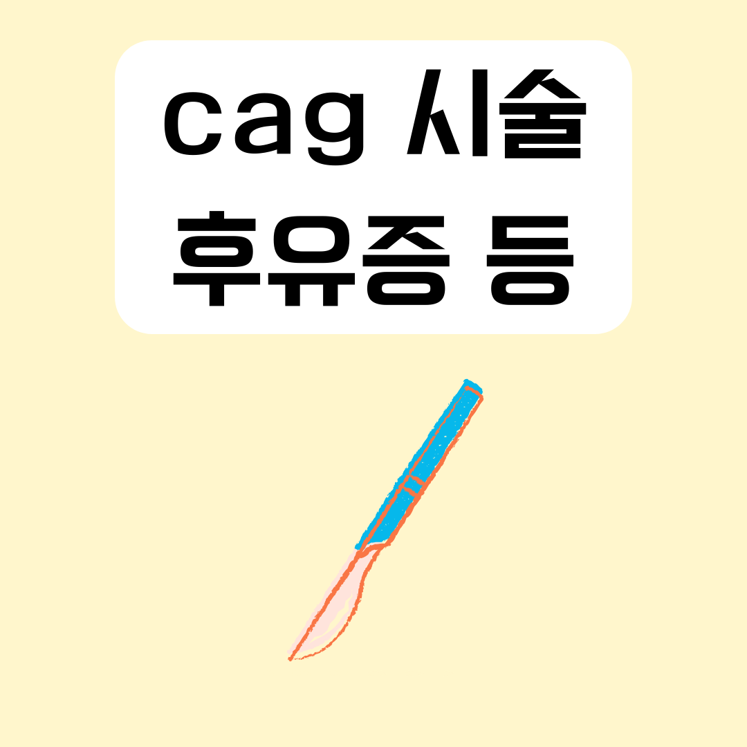 cag-시술-안전성-부작용-후유증