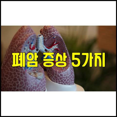  폐암 증상 5가지