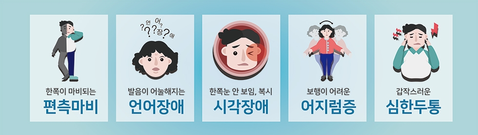 뇌경색 초기증상 원인 자가진단 정보 총정리5