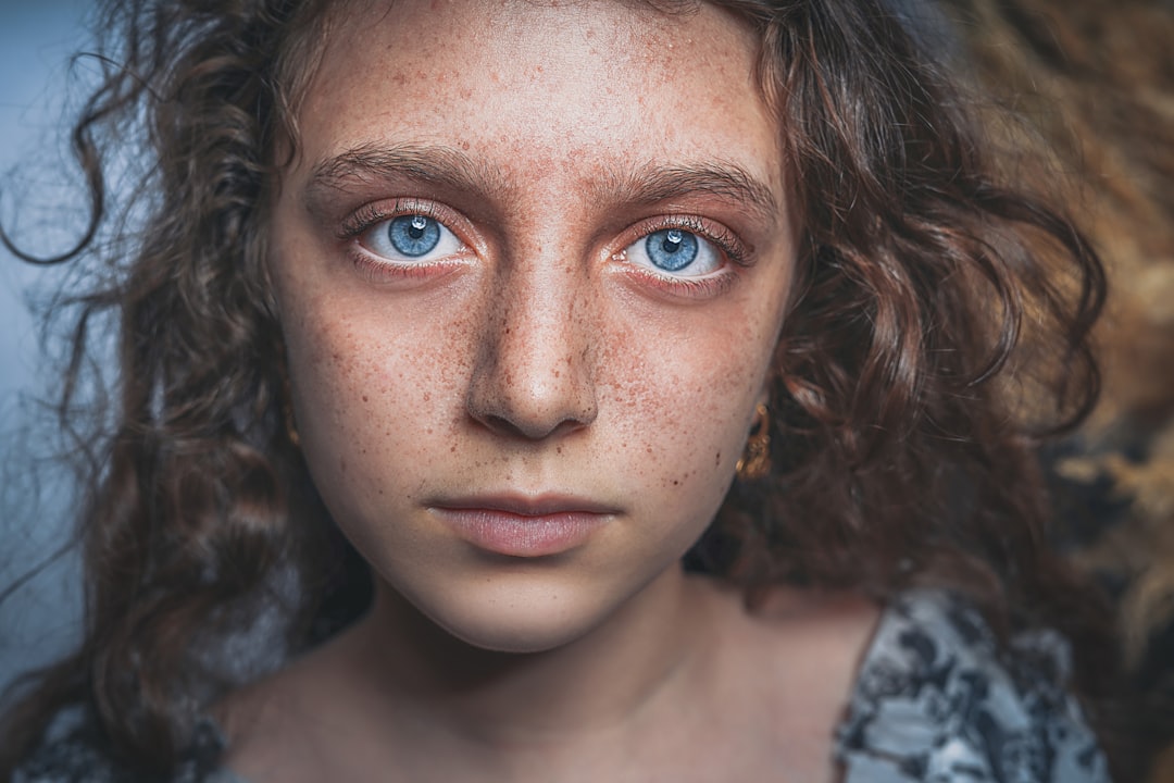 'Acne'