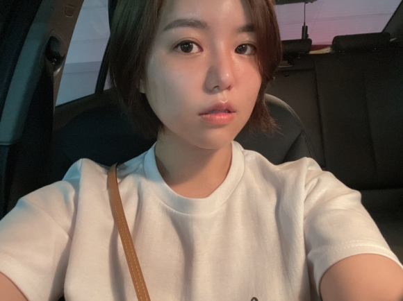 이마필러잘하는곳 후기! 5