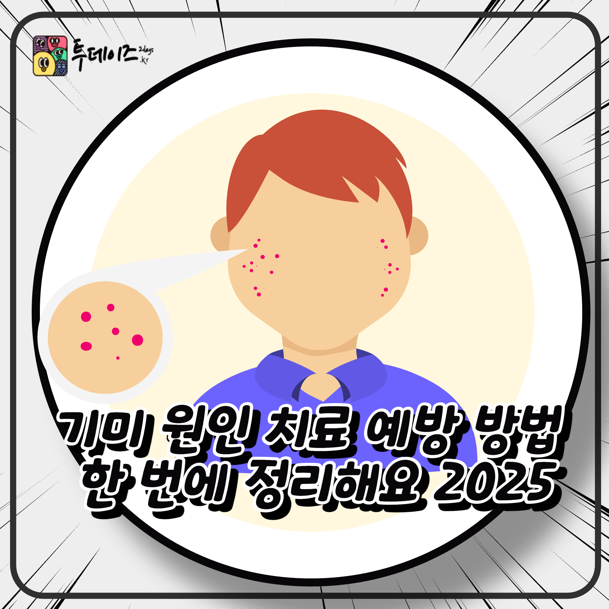 기미 원인 치료 예방 방법 한 번에 정리해요 2025